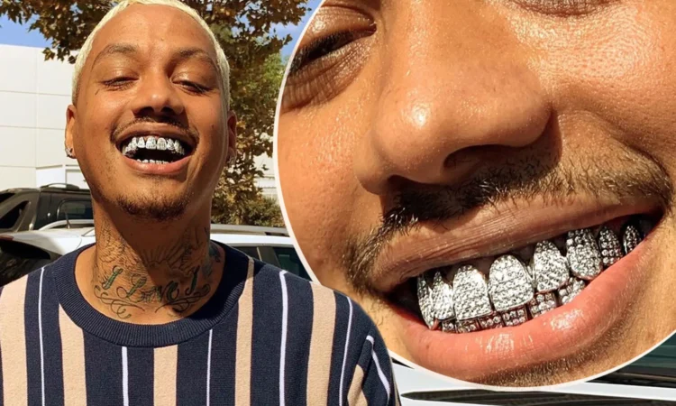 From Rappers to Royalty: The Evolution of Diamond Grillz